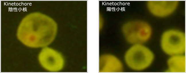 Kinetochore陰性小核
、陽性小核