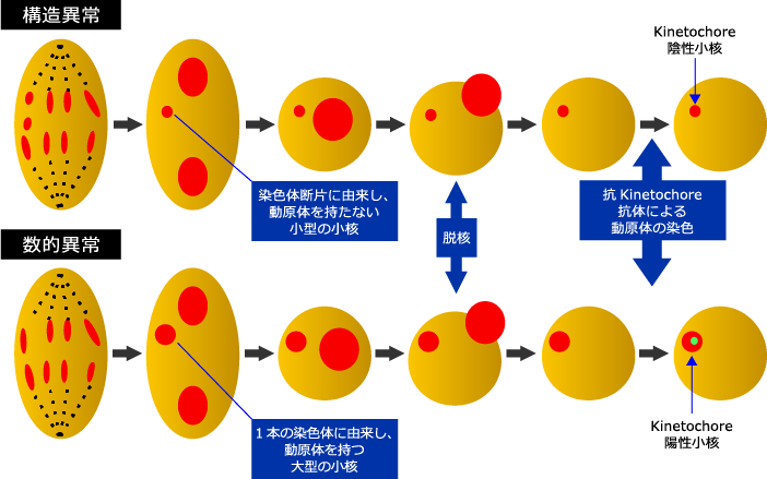 構造異常、数的異常